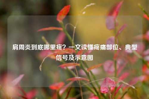 肩周炎到底哪里疼?一文读懂疼痛部位、典型信号及示意图